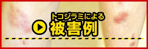 トコジラミによる被害